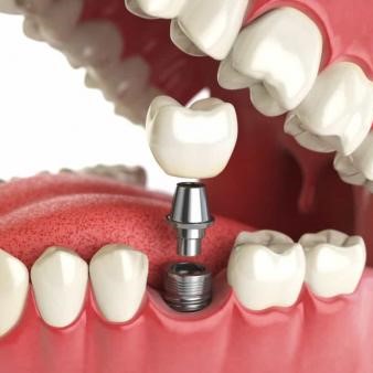 дентальна стоматологія