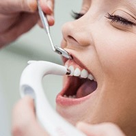 терапевтична стоматологія